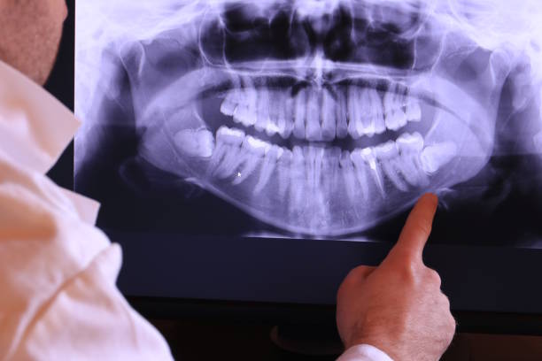 Best Emergency Denture Repair in Rankin, TX